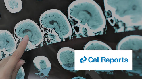 A Diet Mimicking Fasting Promotes Regeneration and Reduces Autoimmunity and Multiple Sclerosis Symptoms